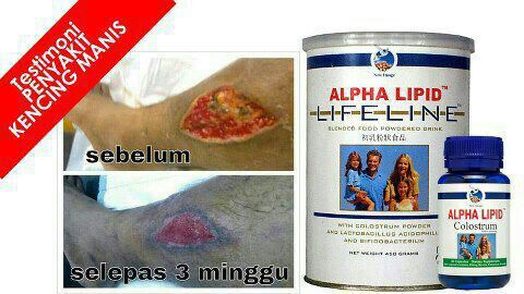 Kencing Manis Dengan Alpha Lipid 